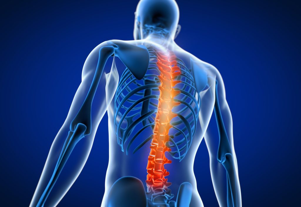 Spinal Compression Fracture - Symptoms, Causes and Treatment