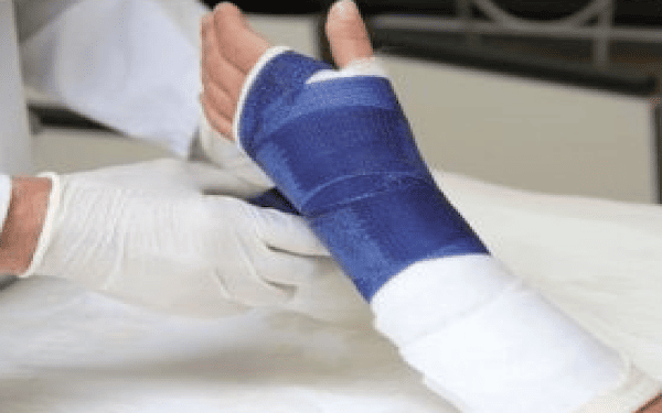 Doctor wrapping a hand in a cast