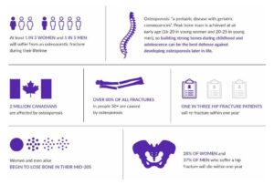 Osteoporosis Fast Facts
