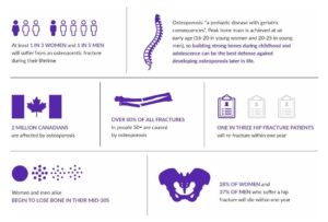 Osteoporosis Facts and Statistics Infographic